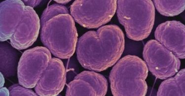Gonorrhea is becoming unstoppable; highly resistant cases found in US