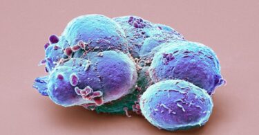 After 25 years of hype, embryonic stem cells are still waiting for their moment